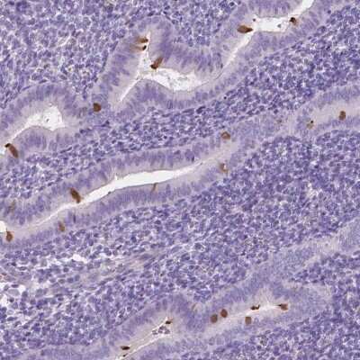 Immunohistochemistry-Paraffin: EFCAB1 Antibody [NBP1-82313]