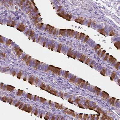 Immunohistochemistry-Paraffin: EFCAB1 Antibody [NBP1-82313]