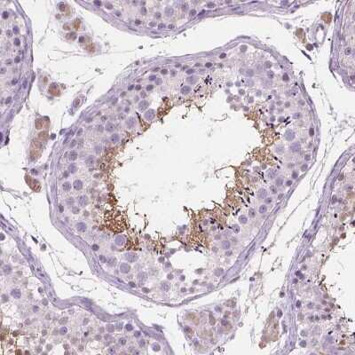 Immunohistochemistry-Paraffin: EFCAB1 Antibody [NBP1-82313]