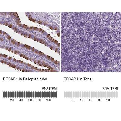 Immunohistochemistry-Paraffin: EFCAB1 Antibody [NBP1-82313]