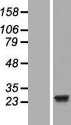 Western Blot: EFCAB1 Overexpression Lysate [NBL1-10129]