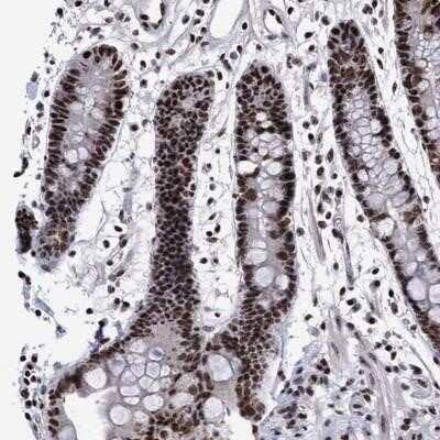 Immunohistochemistry-Paraffin: EFCAB10 Antibody [NBP1-91080]