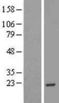 Western Blot: EFCAB11 Overexpression Lysate [NBL1-08177]