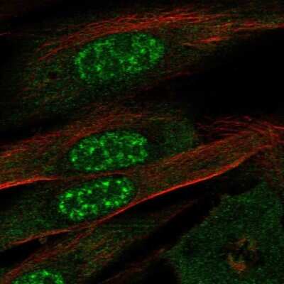 Immunocytochemistry/ Immunofluorescence: EFCAB13 Antibody [NBP1-83456]