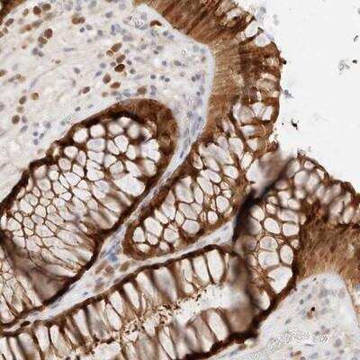 Immunohistochemistry-Paraffin: EFCAB13 Antibody [NBP1-83454]