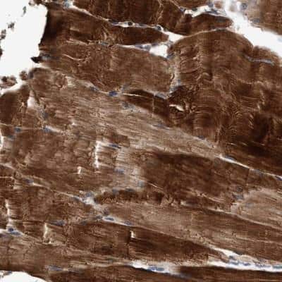 Immunohistochemistry-Paraffin: EFCAB13 Antibody [NBP1-83456]