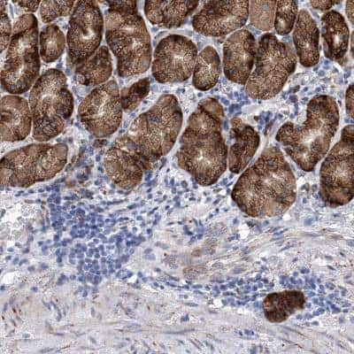 Immunohistochemistry: EFCAB2 Antibody [NBP1-81219]
