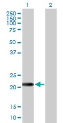 Western Blot: EFCAB2 Antibody [H00084288-B01P]