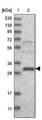 Western Blot: EFCAB2 Antibody [NBP1-81219]