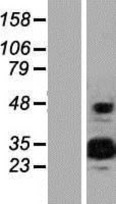 Western Blot: EFCAB2 Overexpression Lysate [NBP2-06047]