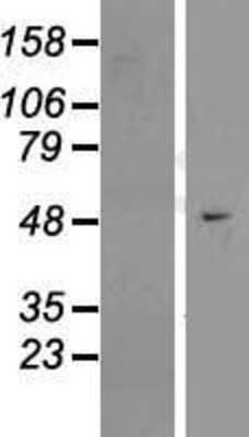 Western Blot: EFCAB3 Overexpression Lysate [NBL1-10131]