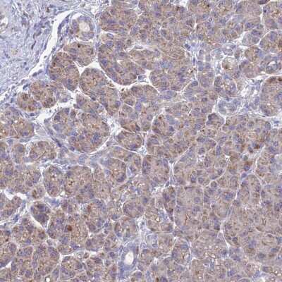 Immunohistochemistry-Paraffin: EFCAB4A Antibody [NBP1-91863]
