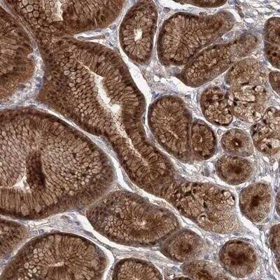 Immunohistochemistry-Paraffin: EFCAB4B Antibody [NBP1-82687]