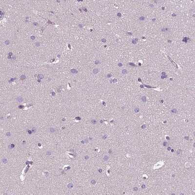 Immunohistochemistry-Paraffin: EFCAB4B Antibody [NBP1-82687]
