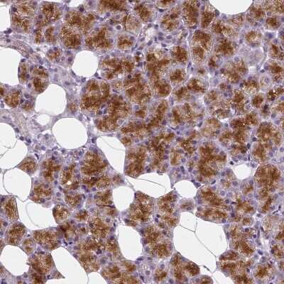 Immunohistochemistry-Paraffin: EFCAB4B Antibody [NBP1-82687]