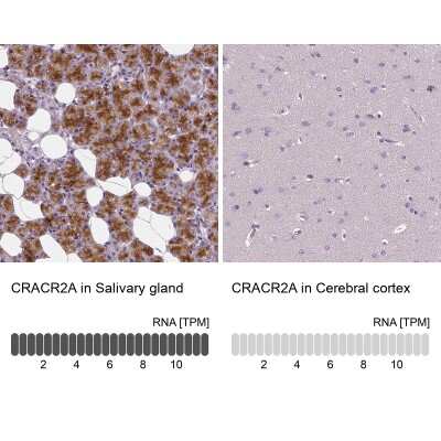 Immunohistochemistry-Paraffin: EFCAB4B Antibody [NBP1-82687]