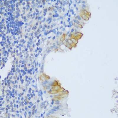 Immunohistochemistry-Paraffin: EFCAB4B Antibody - Azide and BSA Free [NBP2-92725]
