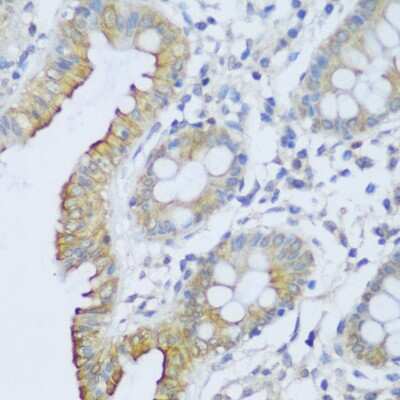 Immunohistochemistry-Paraffin: EFCAB4B Antibody - Azide and BSA Free [NBP2-92725]