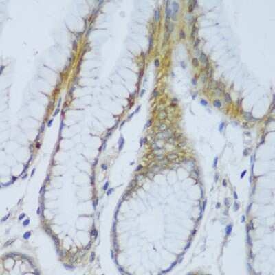 Immunohistochemistry-Paraffin: EFCAB4B Antibody - Azide and BSA Free [NBP2-92725]