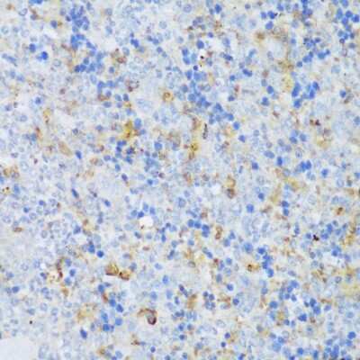 Immunohistochemistry-Paraffin: EFCAB4B Antibody - Azide and BSA Free [NBP2-92725]