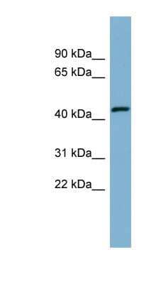 Western Blot: EFCAB4B Antibody [NBP1-55340]