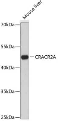 Western Blot: EFCAB4B AntibodyAzide and BSA Free [NBP2-92725]