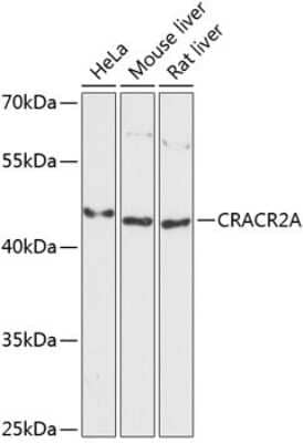 Western Blot: EFCAB4B AntibodyAzide and BSA Free [NBP2-92726]