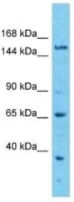 Western Blot: EFCAB5 Antibody [NBP3-10768]