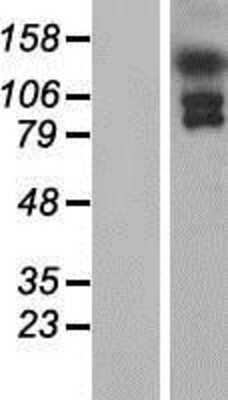 Western Blot: EFCAB6 Overexpression Lysate [NBP2-04672]