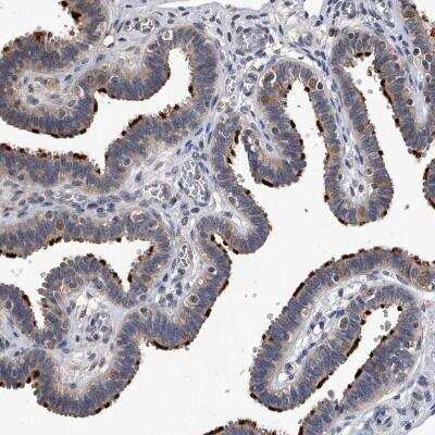 Immunohistochemistry: EFCAB7 Antibody [NBP1-81374]