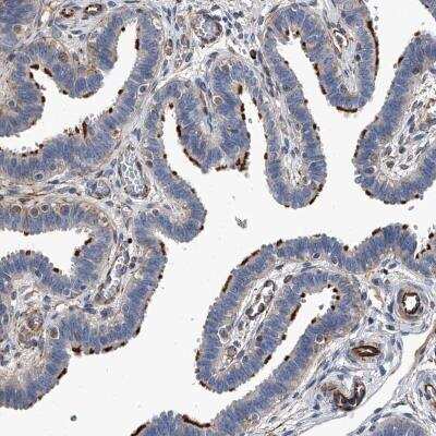 Immunohistochemistry-Paraffin: EFCAB7 Antibody [NBP1-81372]