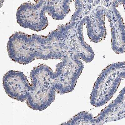 Immunohistochemistry-Paraffin: EFCAB7 Antibody [NBP1-81373]