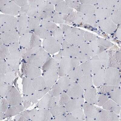 Immunohistochemistry-Paraffin: EFCAB7 Antibody [NBP1-81373]