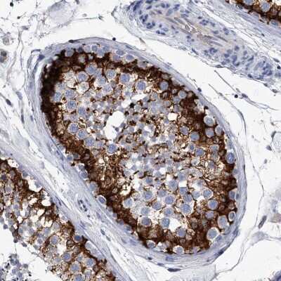 Immunohistochemistry-Paraffin: EFCAB7 Antibody [NBP1-81373]