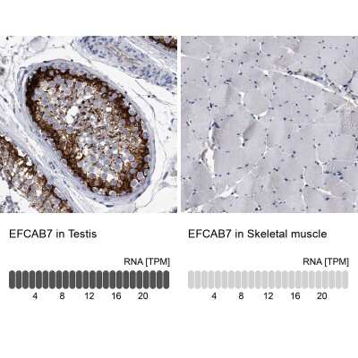 Immunohistochemistry-Paraffin: EFCAB7 Antibody [NBP1-81373]