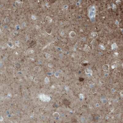 Immunohistochemistry-Paraffin: EFCBP2 Antibody (CL0524) [NBP2-52951]