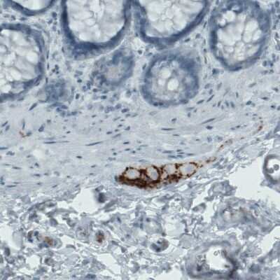 Immunohistochemistry-Paraffin: EFCBP2 Antibody (CL0524) [NBP2-52951]