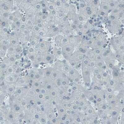 Immunohistochemistry-Paraffin: EFCBP2 Antibody (CL0524) [NBP2-52951]