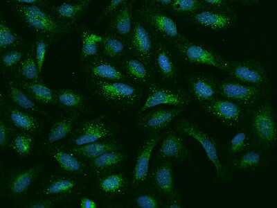 Immunocytochemistry/ Immunofluorescence: EFCBP2 Antibody [NBP2-97439]