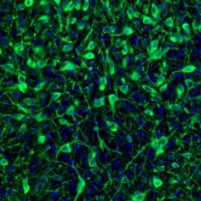 Immunohistochemistry: EFCBP2 Antibody [NBP1-84002]