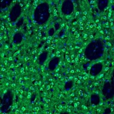 Immunohistochemistry: EFCBP2 Antibody [NBP1-84002]