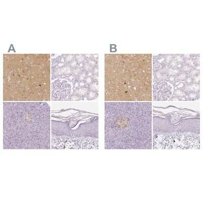Immunohistochemistry-Paraffin: EFCBP2 Antibody [NBP1-84001]