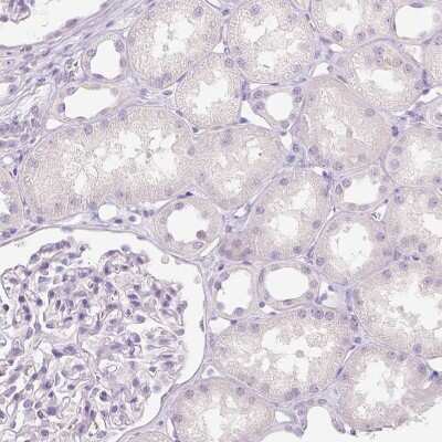 Immunohistochemistry-Paraffin: EFCBP2 Antibody [NBP1-84001]