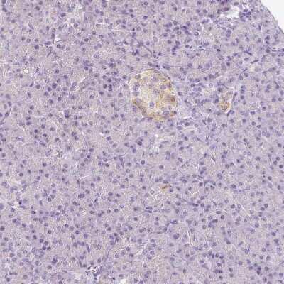 Immunohistochemistry-Paraffin: EFCBP2 Antibody [NBP1-84001]
