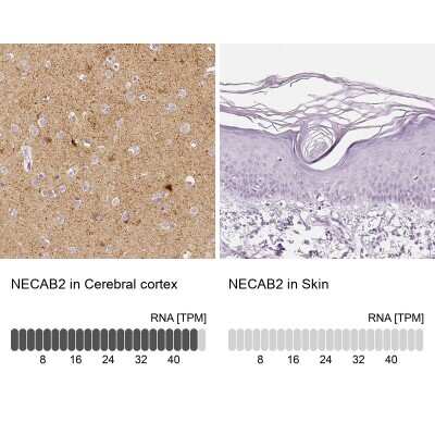 Immunohistochemistry-Paraffin: EFCBP2 Antibody [NBP1-84001]