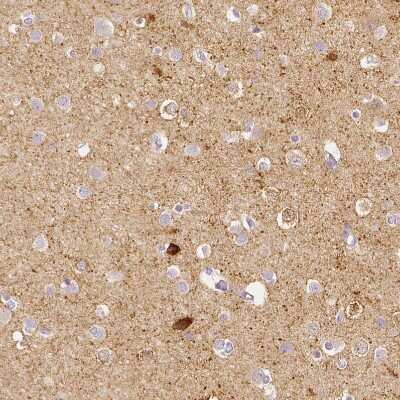 Immunohistochemistry-Paraffin: EFCBP2 Antibody [NBP1-84002]