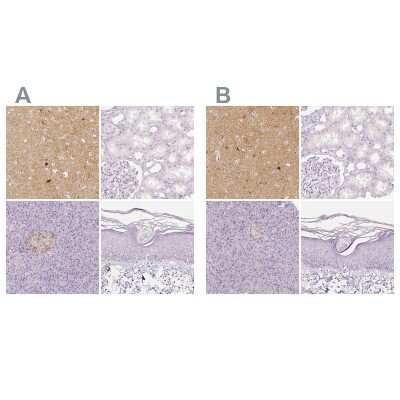 Immunohistochemistry-Paraffin: EFCBP2 Antibody [NBP1-84002]