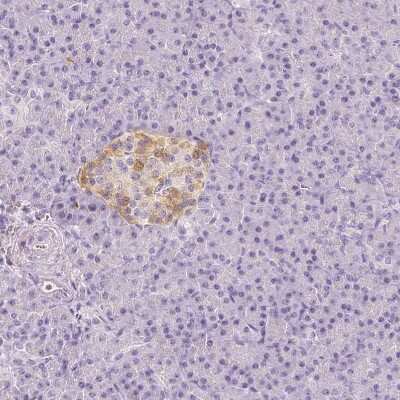 Immunohistochemistry-Paraffin: EFCBP2 Antibody [NBP1-84002]