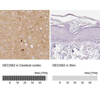 Immunohistochemistry-Paraffin: EFCBP2 Antibody [NBP1-84002]