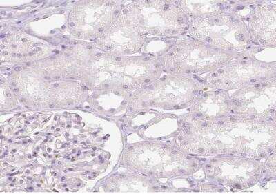Immunohistochemistry-Paraffin: EFCBP2 Antibody [NBP1-84002]